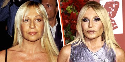 donatella versace intervista dopo la morte|donatella versace plastic surgery 2022.